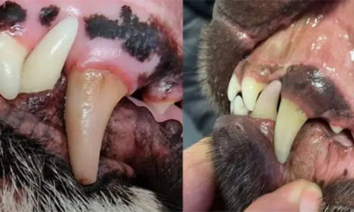 Dental Treatment