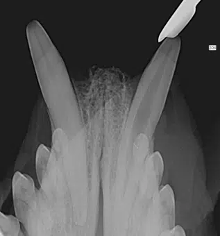 Dental Treatment